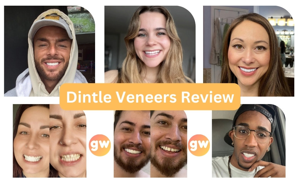 Dintle Veneers Review - go wellness best